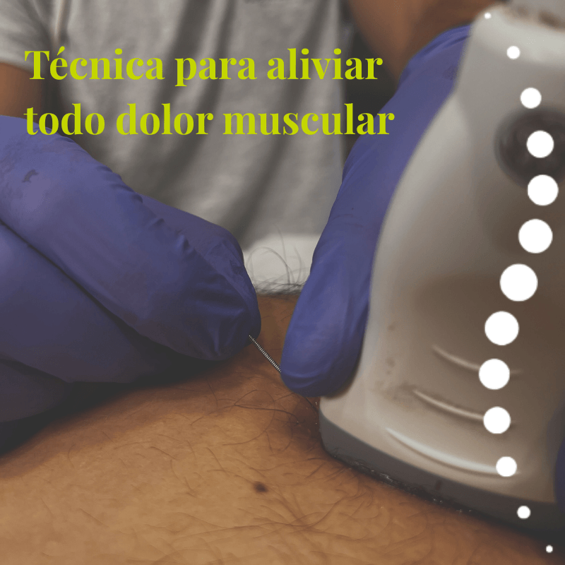 Punción Seca en Madrid Alivio Muscular Ecoguiado