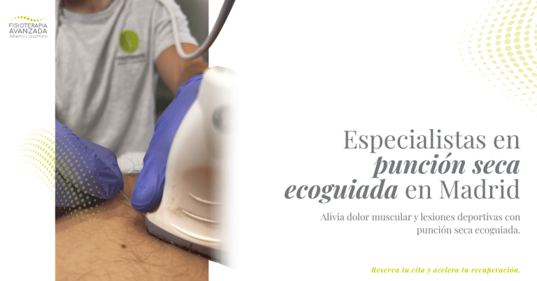 Punción seca en Madrid una técnica ecoguiada para aliviar el dolor muscular y mejorar tu movilidad