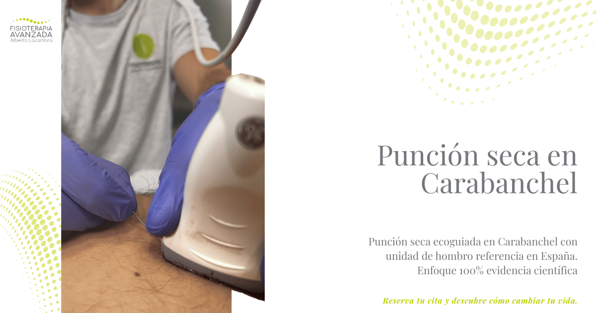 Punción seca en Carabanchel